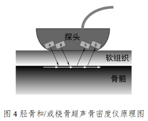 超聲骨密度儀注冊技術審查指導原則(2017年第180號)(圖4) 超聲骨密度儀注冊技術審查指導原則(2017年第180號)(圖4)