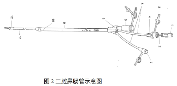 經鼻腸營養導管注冊審查指導原則（2022年第41號）(圖2)