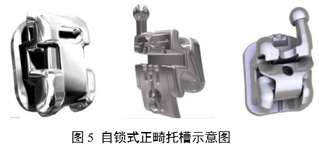 正畸托槽注冊審查指導原則（2022年第41號）(圖5)