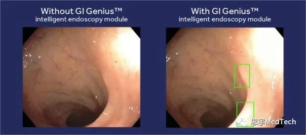 2024全球醫療科技行業十大熱點(圖14) 2024全球醫療科技行業十大熱點(圖14)