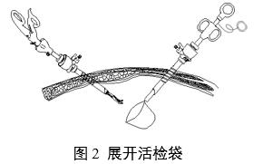 一次性使用內窺鏡用活檢袋注冊審查指導原則(2025年第20號)(圖2) 一次性使用內窺鏡用活檢袋注冊審查指導原則(2025年第20號)(圖2)