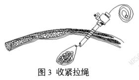 一次性使用內窺鏡用活檢袋注冊審查指導原則(2025年第20號)(圖3) 一次性使用內窺鏡用活檢袋注冊審查指導原則(2025年第20號)(圖3)