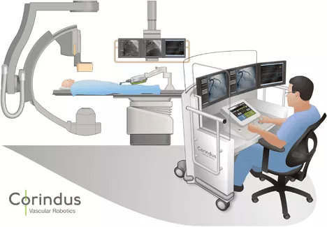 血管腔內介入手術機器人首例臨床試驗案例及未來發展方向(圖2) 血管腔內介入手術機器人首例臨床試驗案例及未來發展方向(圖2)