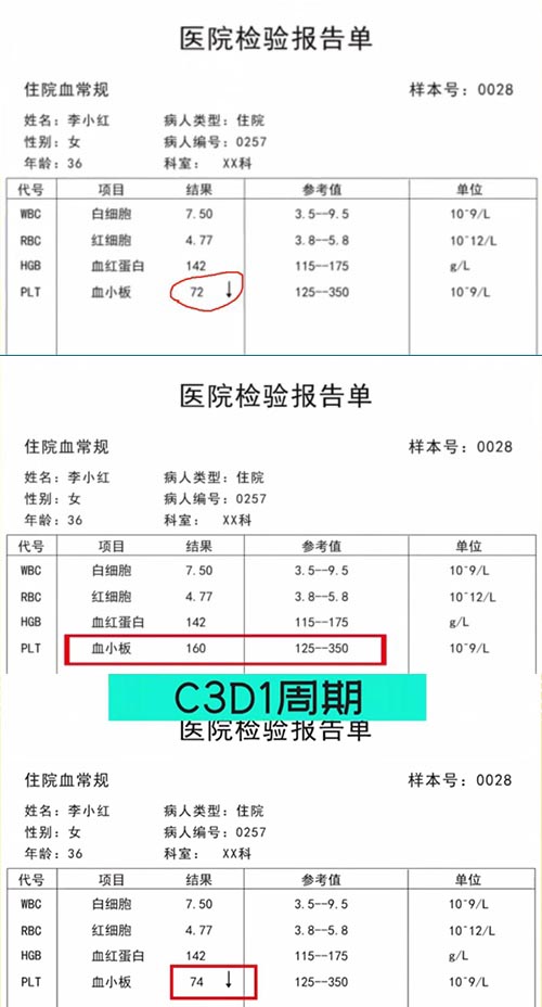 AE與研究藥物關系記錄不一致，如何處理？