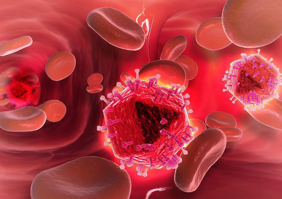 淋巴瘤癌癥臨床試驗(yàn) 干貨丨臨床試驗(yàn)自己做or外包,哪個(gè)更有利?(圖4)