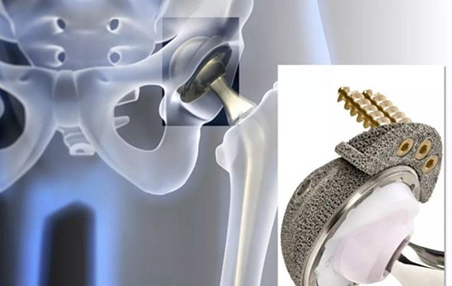 骨科金屬植入物有限元分析資料注冊技術審查指導原則（2020年第48號）(圖1)