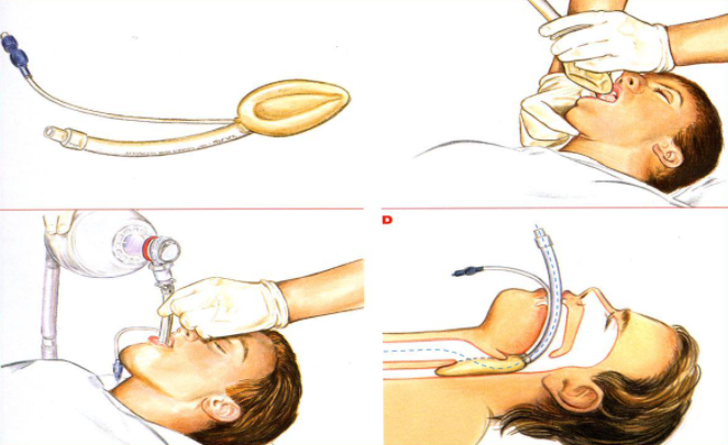 泛談中美醫療器械的分類管理(圖2)